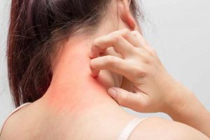 Knowing about skin allergies